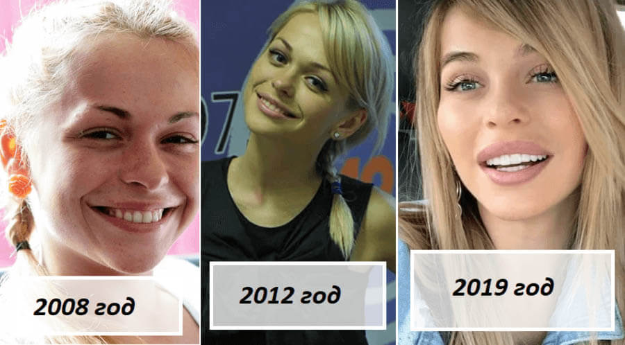 Звезды ТНТ до&nbsp;и&nbsp;после13