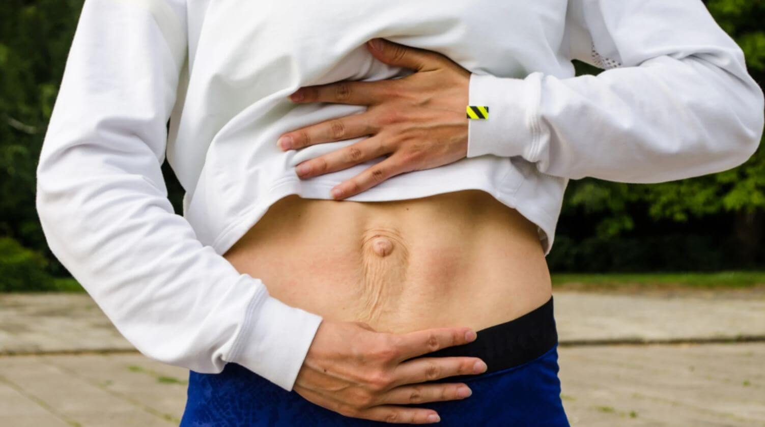 У худых людей диастаз живота виден невооруженным глазом