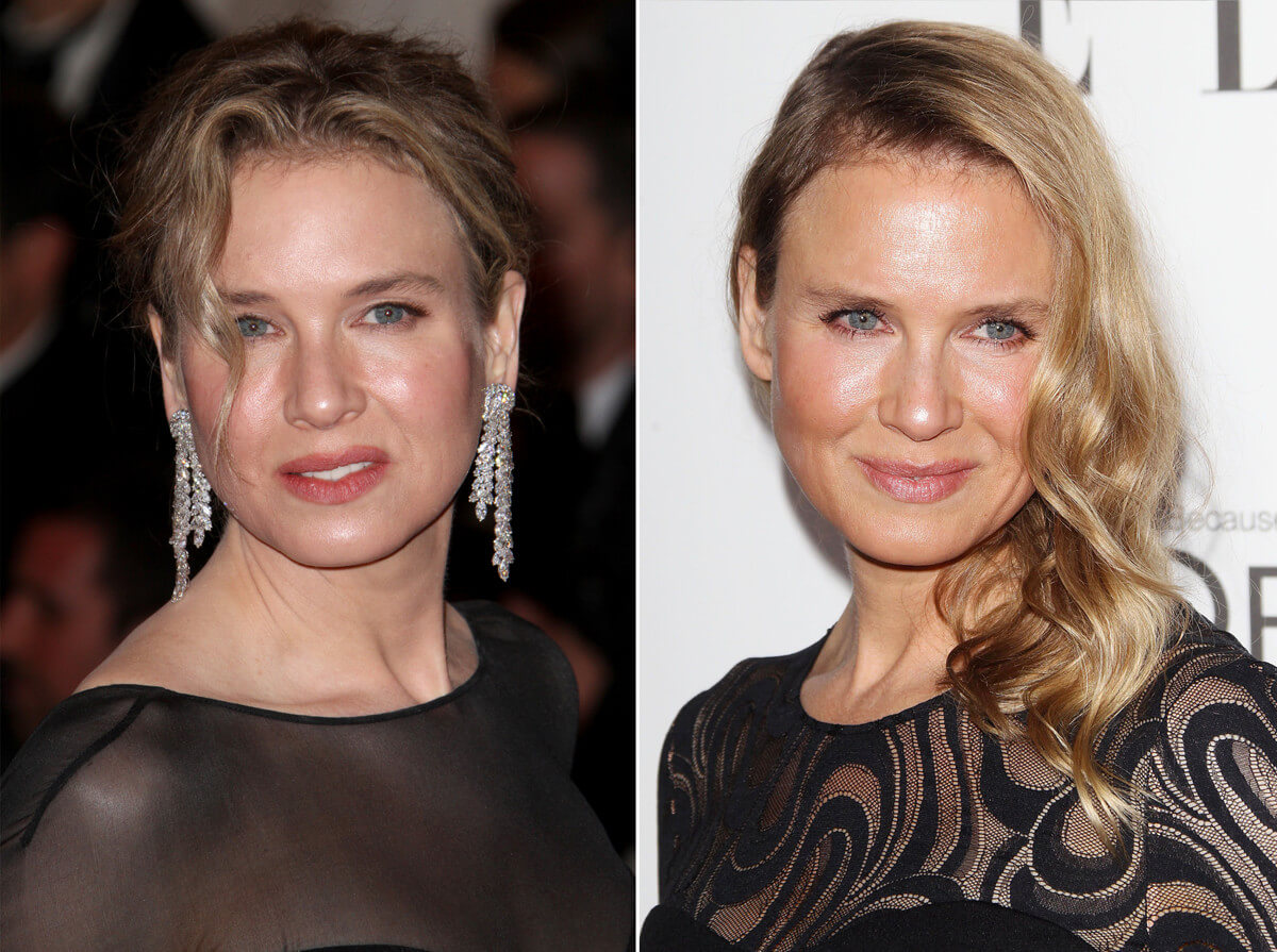 Рене Зельвегер до и после пластики