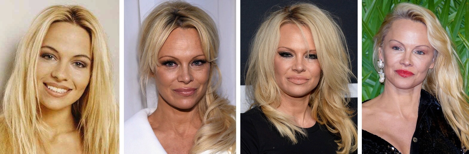 Памела Андерсон до и после пластики