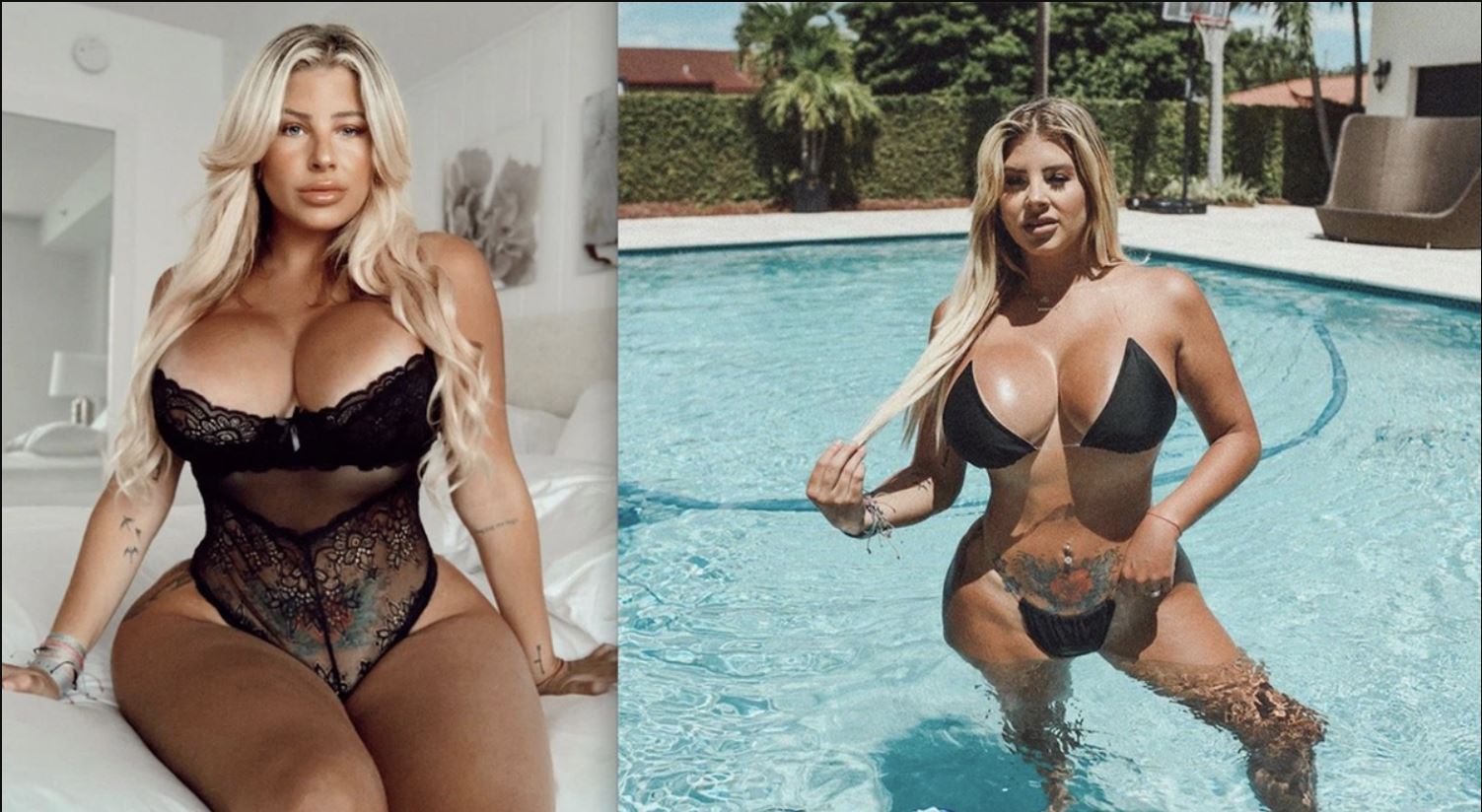  Нейлин превысила рекомендации хирургов по&nbsp;размеру грудных имплантов минимум в&nbsp;2-3 раза