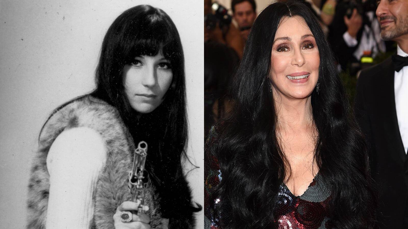 Шер &ndash; до&nbsp;и&nbsp;после пластики