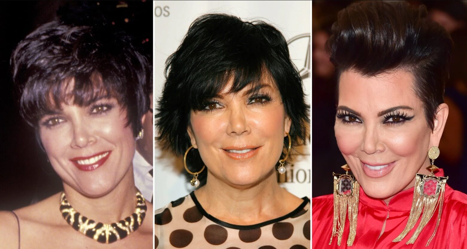 Крис Дженнер &ndash; до&nbsp;и&nbsp;после пластики