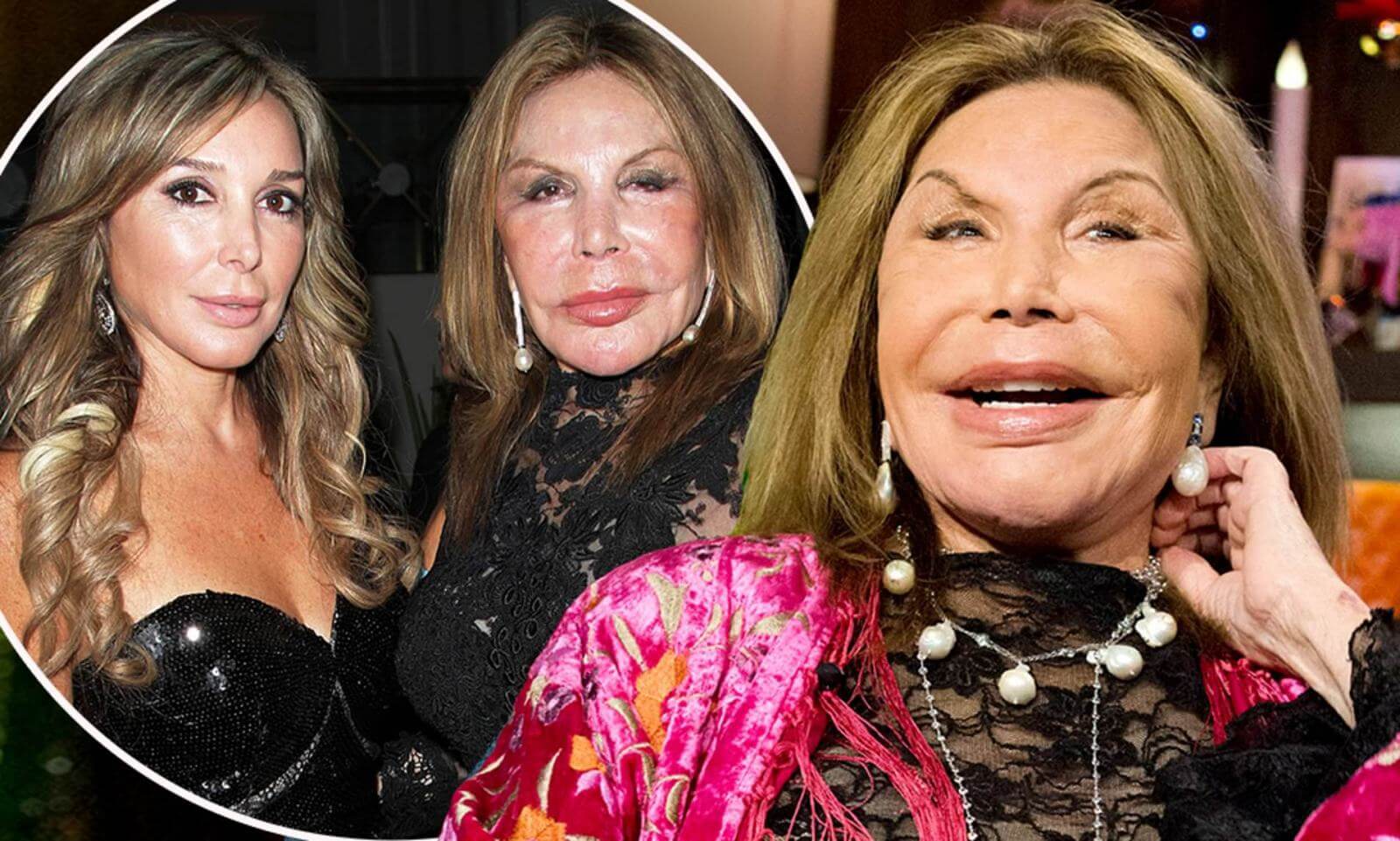 Кому хочется быть похожим на Эльзу Паттон и других людей, которых изуродовала пластика?