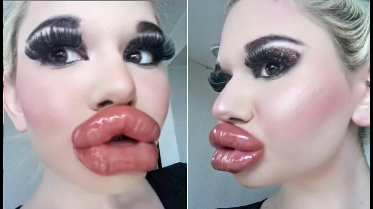 Врачи не&nbsp;хотят и&nbsp;дальше увеличивать Андреа губы, но&nbsp;она непреклонна 