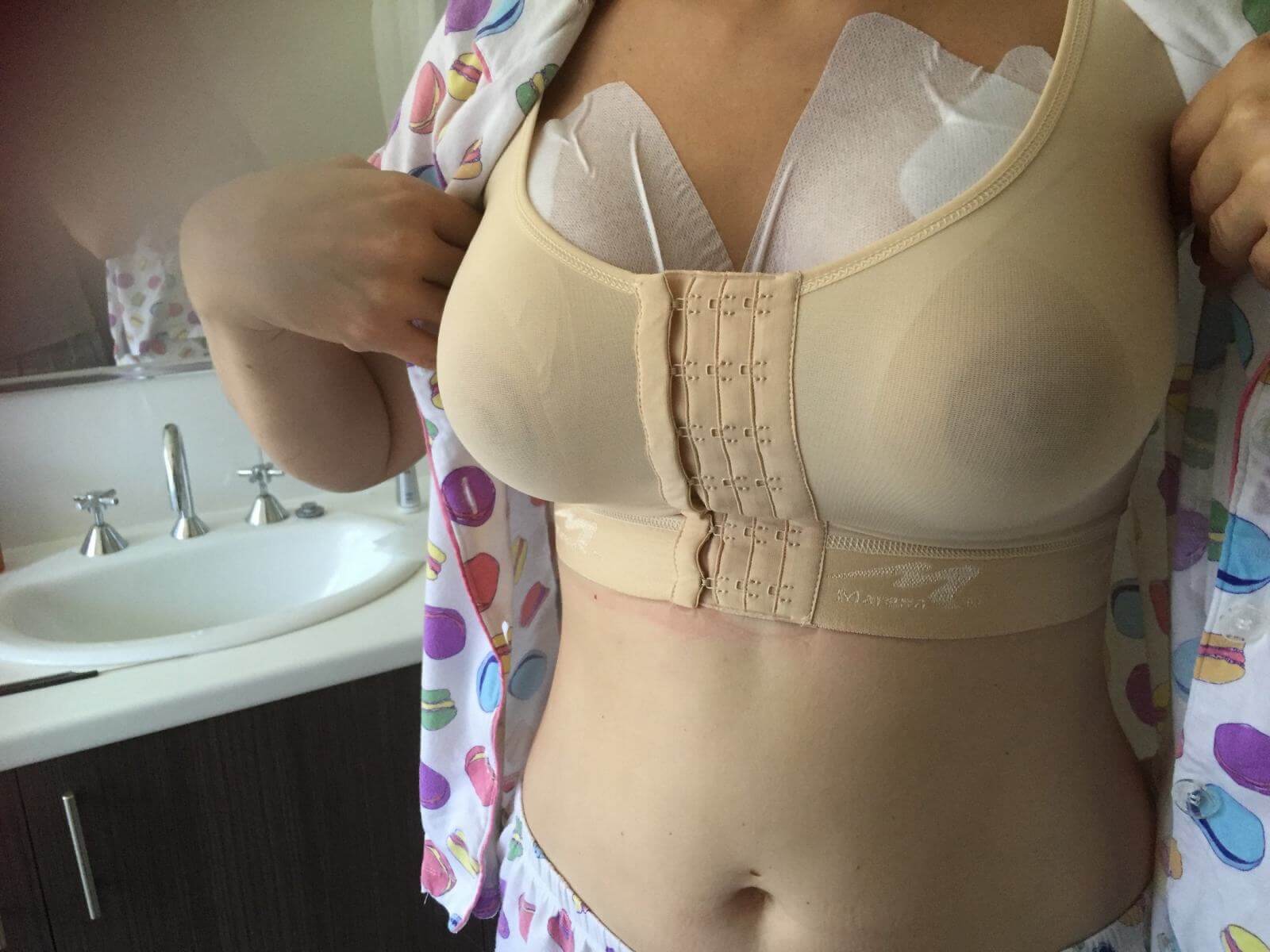 Неправильно подобранное компрессионное белье &ndash; частая причина боли и&nbsp;дискомфорта после пластики груди