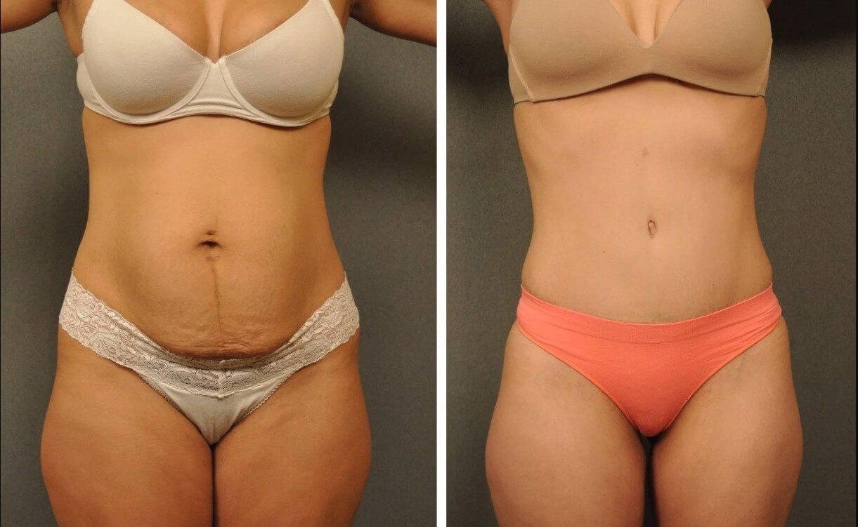 Готовясь к&nbsp;операции, всегда держите в&nbsp;голове ее отличный результат. Самовнушение работает