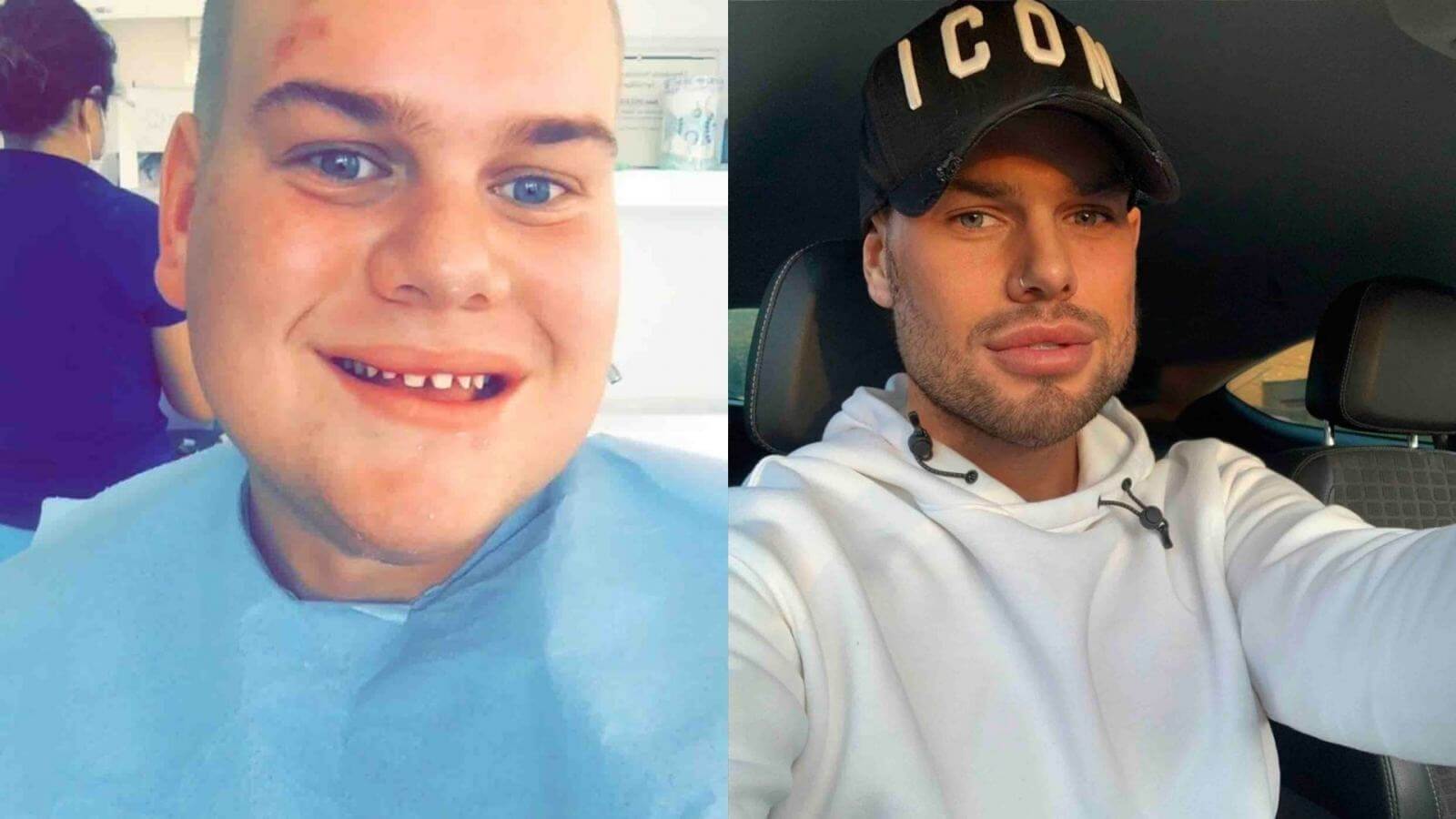 Из смешного пухляша &ndash; в&nbsp;типичного инстабоя