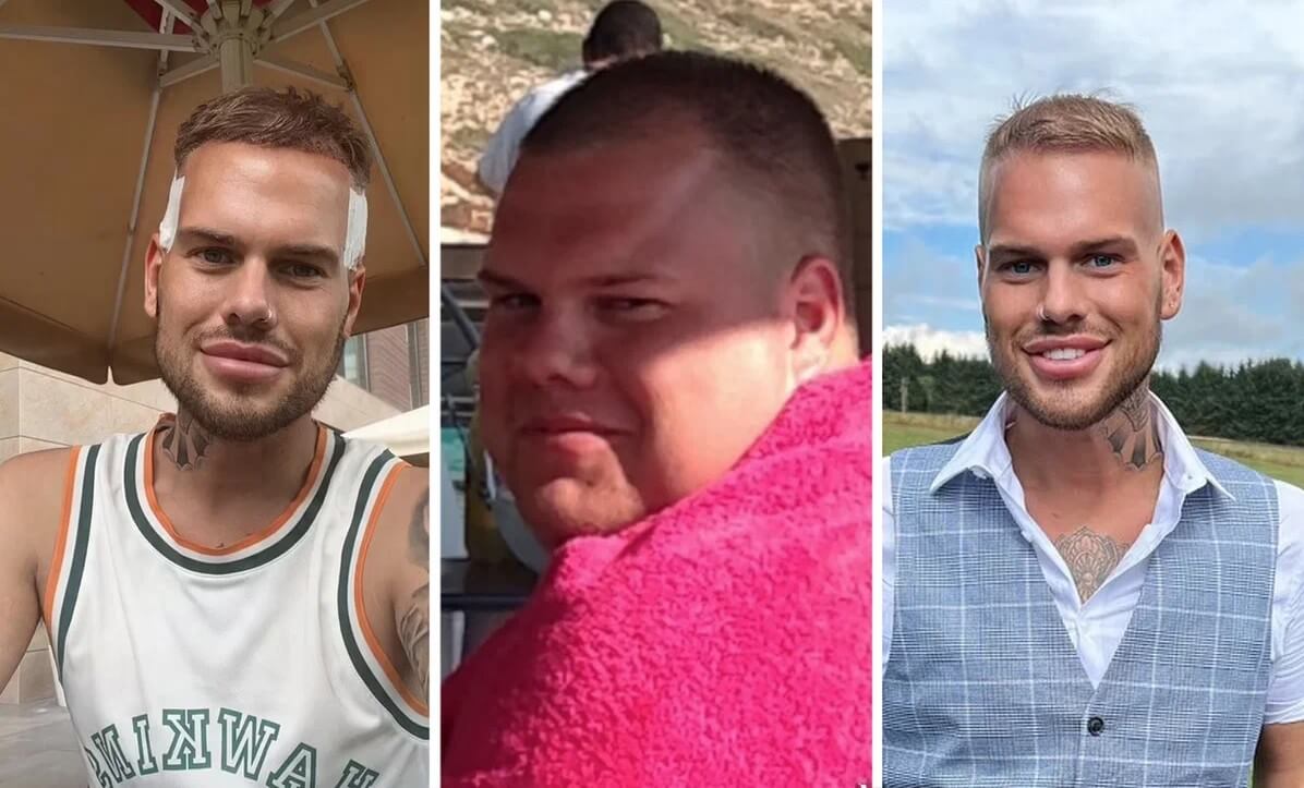 Сейчас Дейл доволен своей внешностью, но&nbsp;душевное равновесие так&nbsp;и&nbsp;не обрел