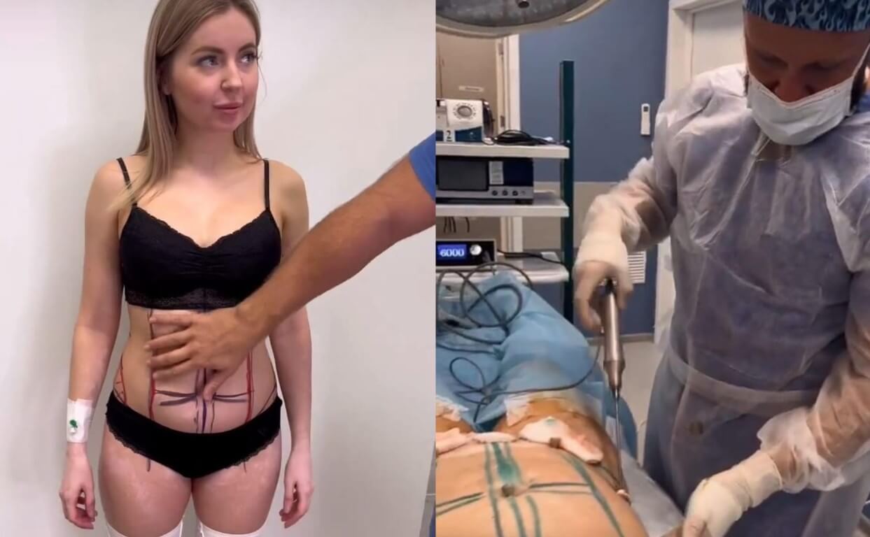 Блогер поделилась откровенными фото и видео из операционной 