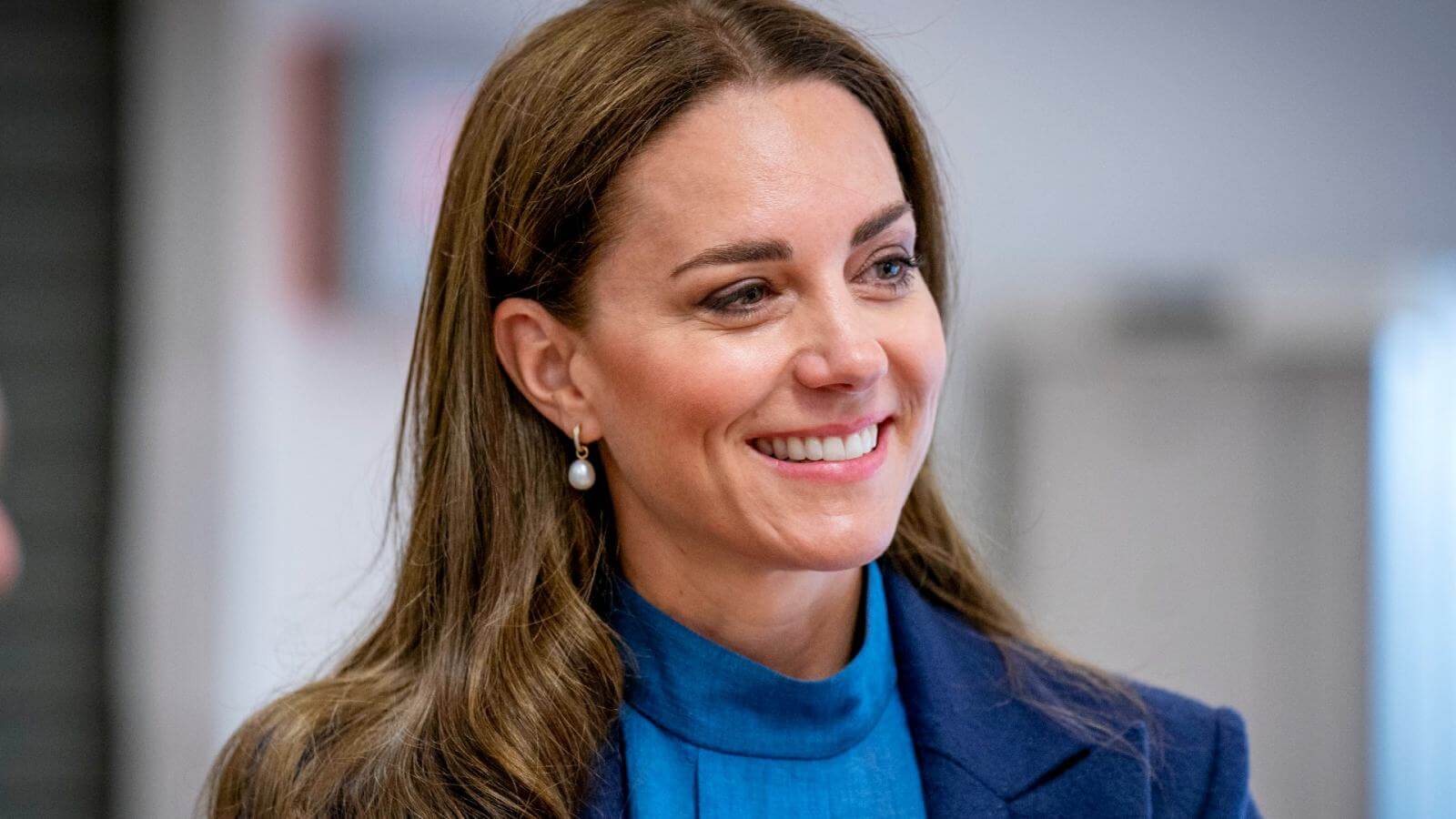 Кейт Миддлтон спровоцировала настоящий бум на димплэктомию в Великобритании и во всем мире