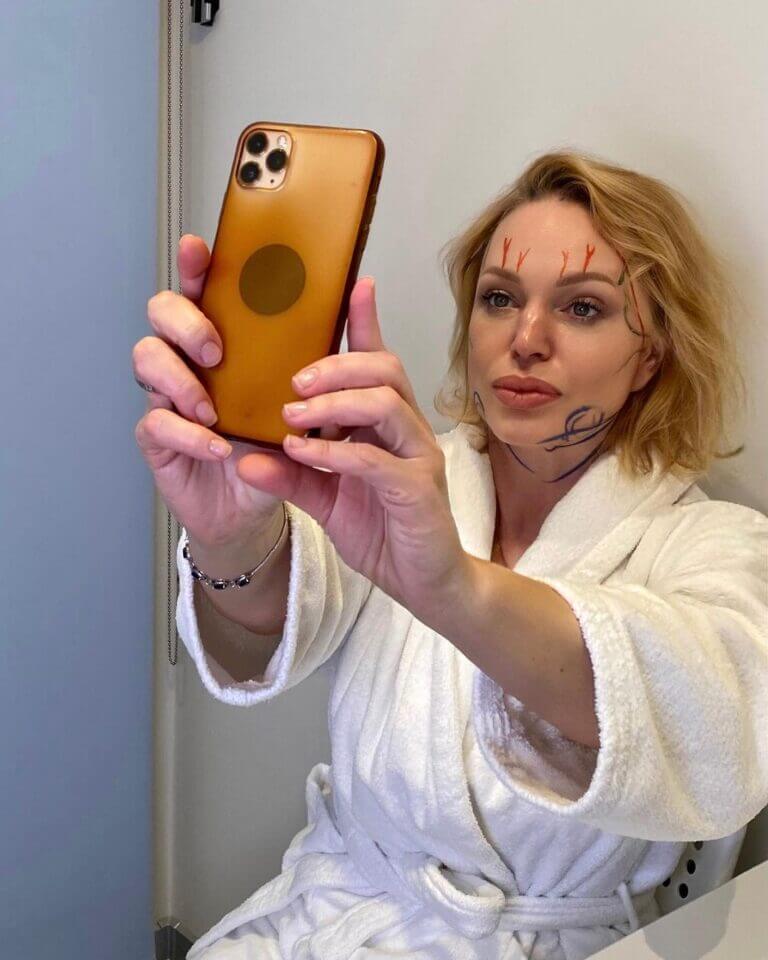  Подтяжку лица Довлатова решила не&nbsp;скрывать от&nbsp;журналистов и&nbsp;фанатов