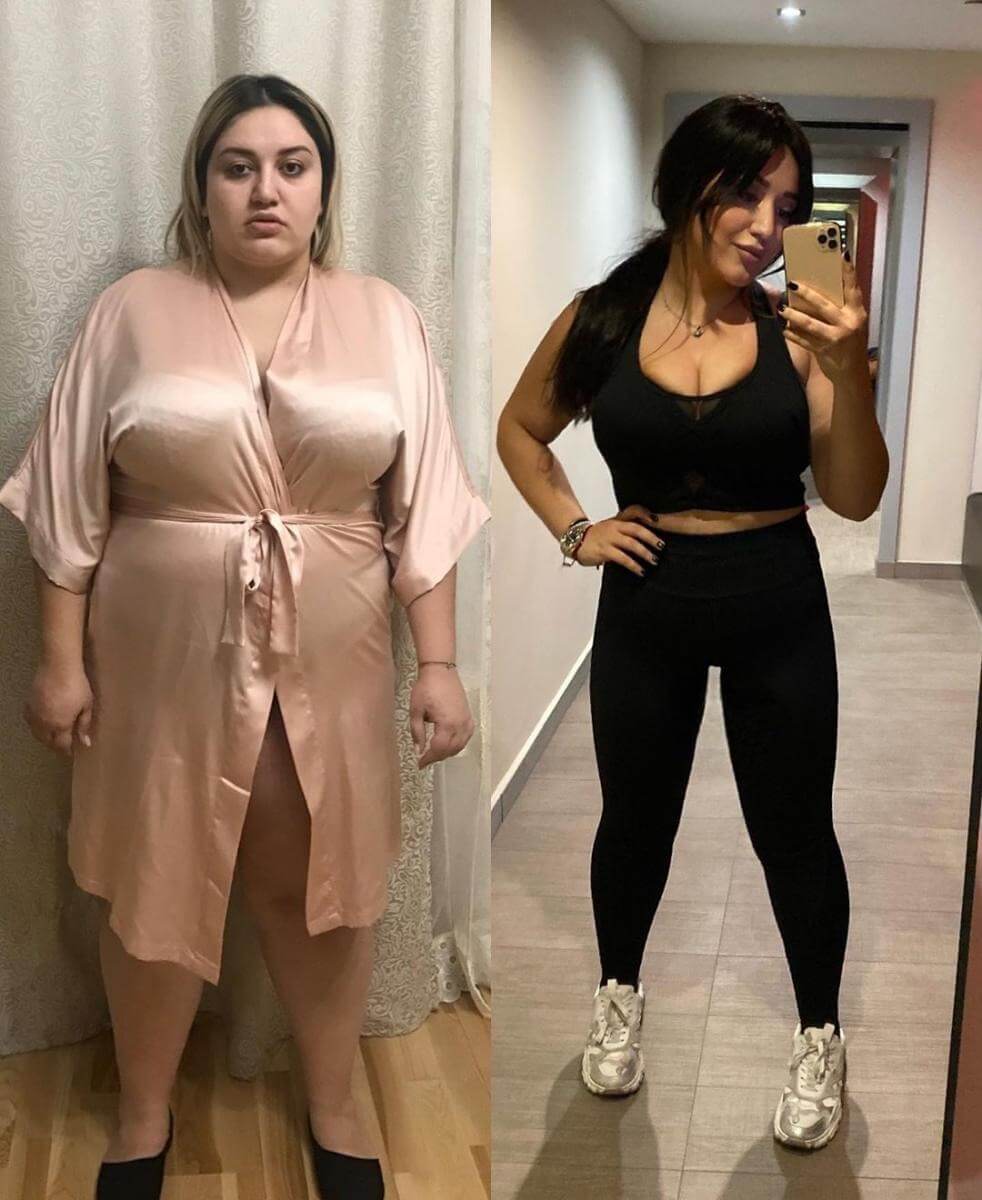 Гоар Аветисян до и после похудения