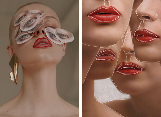 Когда пластика не&nbsp;нужна &ndash; ее не&nbsp;будут делать