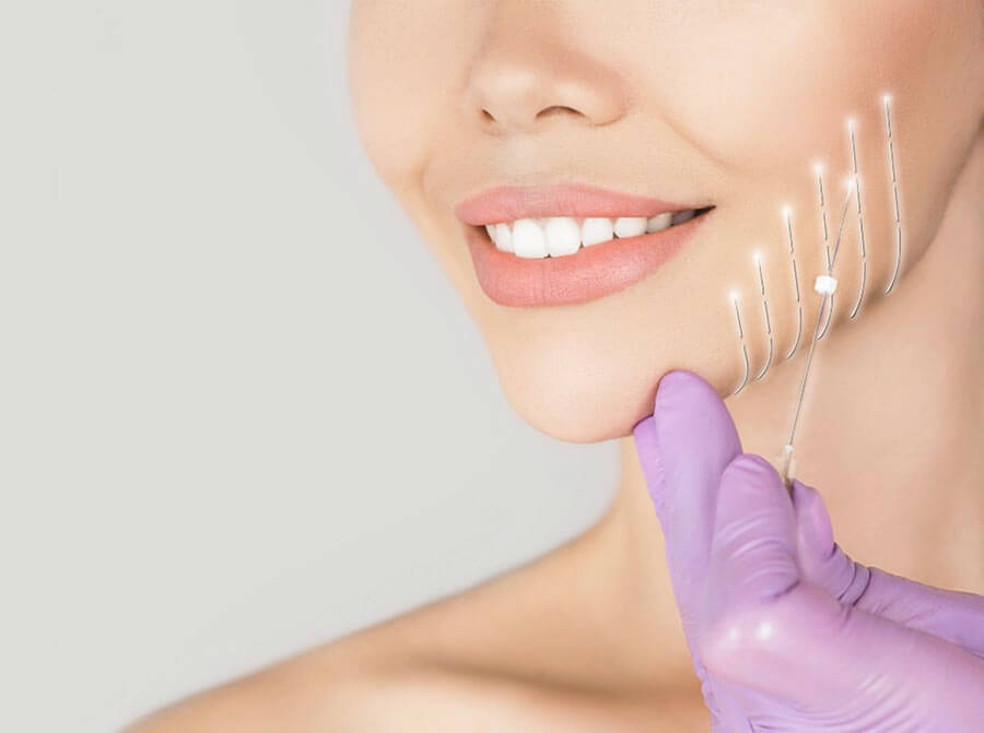 Как работают нити для&nbsp;лица?