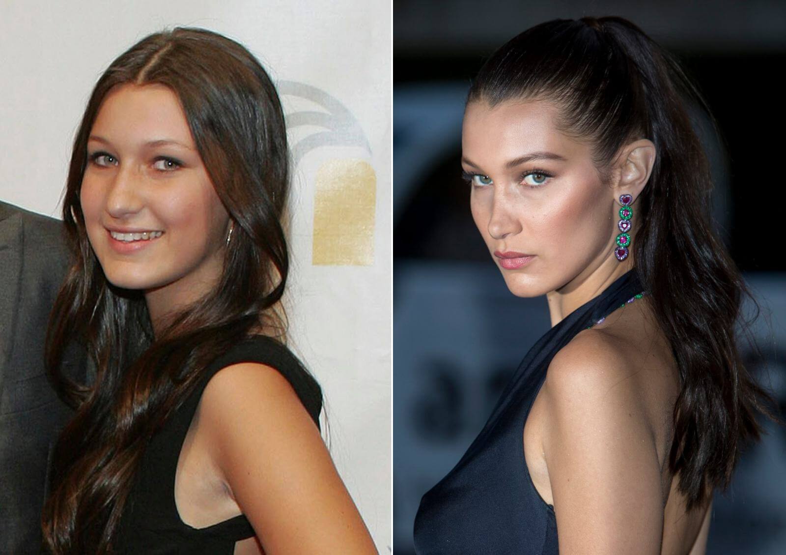 Пластика Беллы Хадид