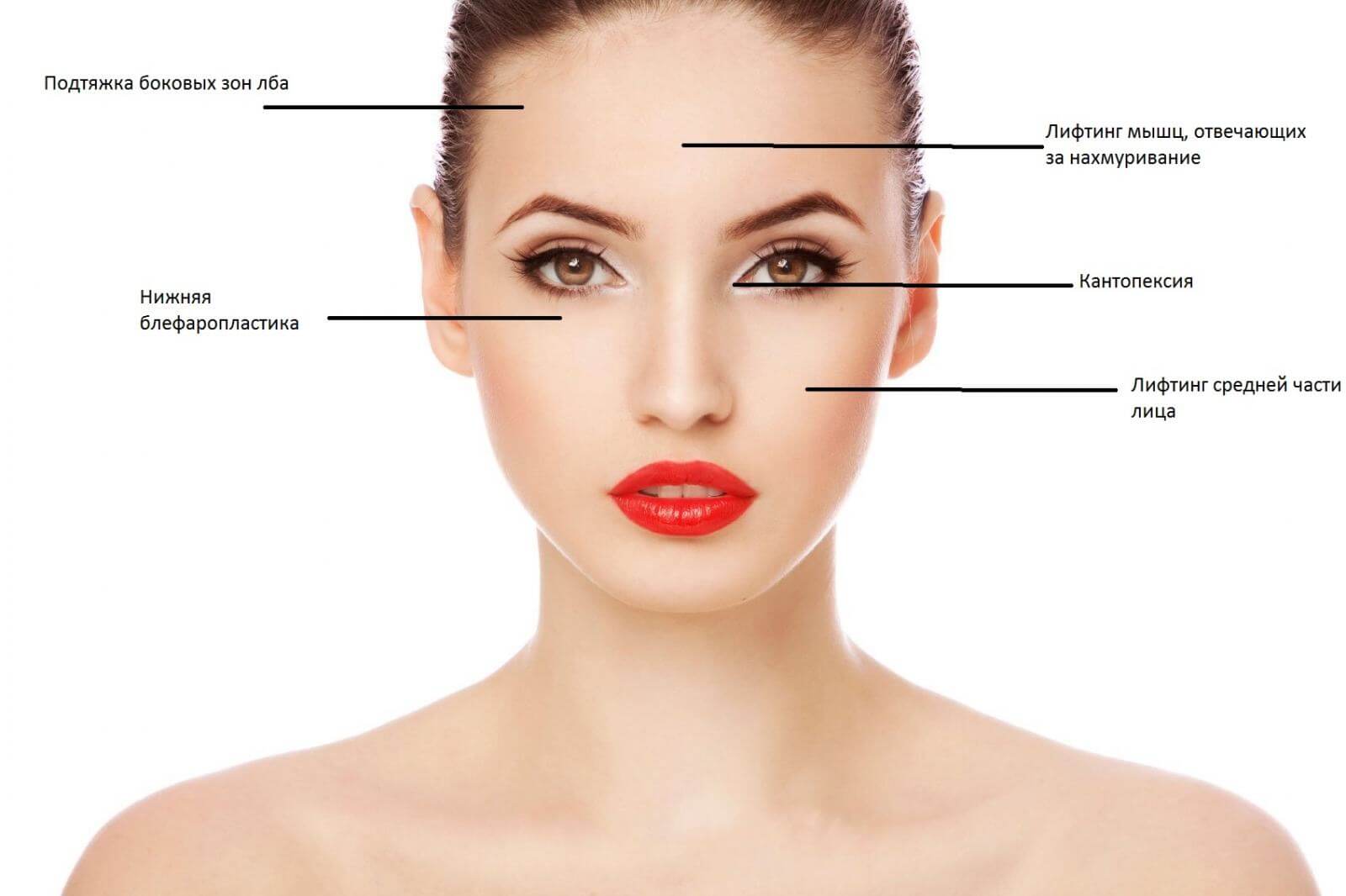 Схема выполнения процедуры хирургического омоложения Mag-5