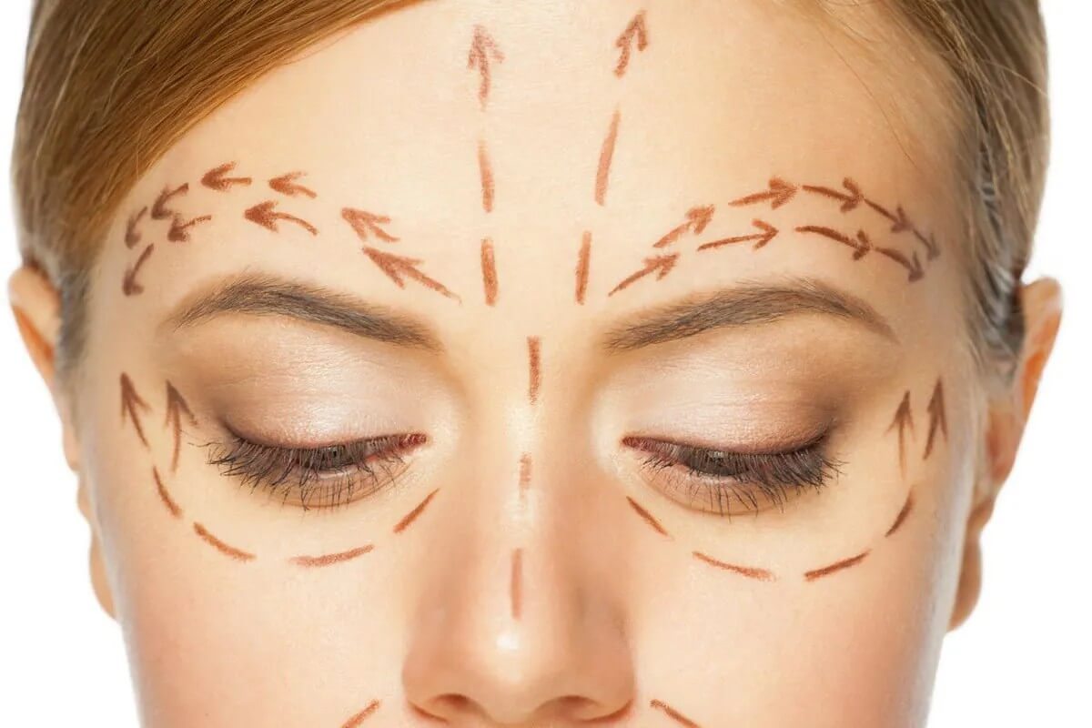 Комплексная подтяжка уделяет большое внимание омоложению зоны вокруг глаз, и в этом один из главных секретов ее успеха