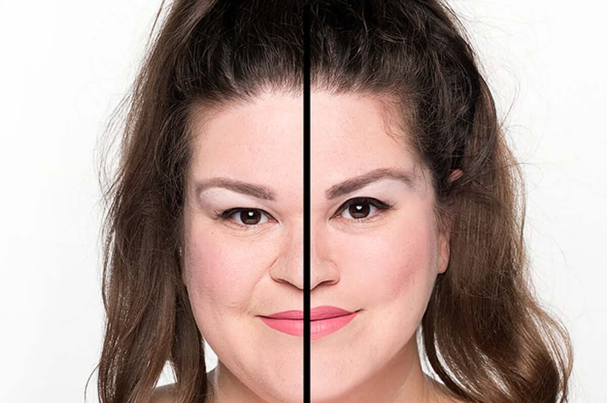 Комплексная подтяжка борется сразу с несколькими яркими признаками старения, поэтому ее результаты всегда выглядят впечатляюще