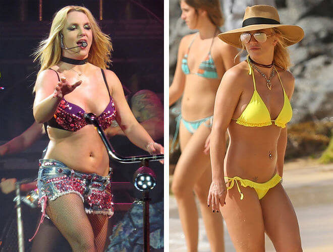 Звездная абдоминопластика Бритни Спирс – фото до после