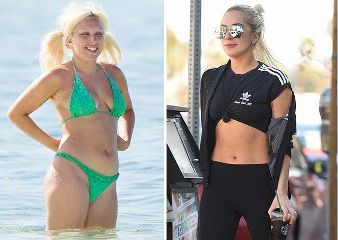 Фото Леди Гаги до после абдоминопластики