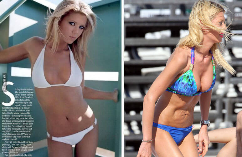 Тара Рид фото до и после абдоминопластики