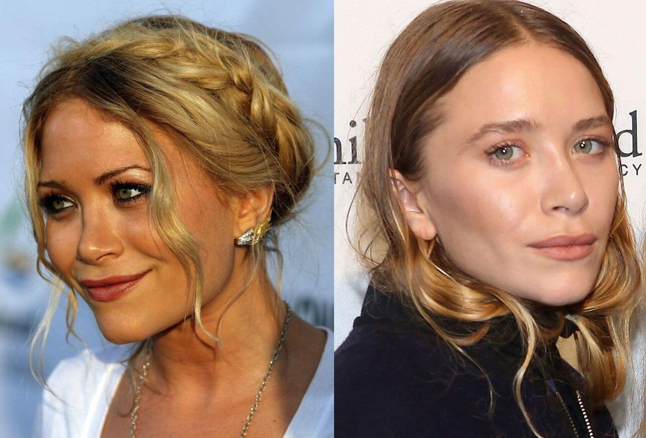 Мэри-Кейт Олсен до и после пластики