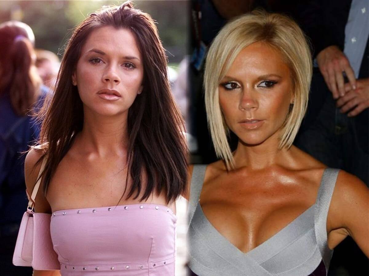 Виктория Бэкхем до и после пластики