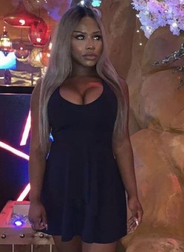 Деньги на&nbsp;пластику Монифе принесли подписчики из&nbsp;интернета