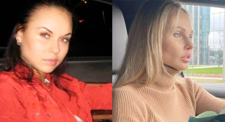 37-летняя Надежда активно прибегает к&nbsp;косметологии и&nbsp;пластической хирургии для&nbsp;улучшения своей внешности