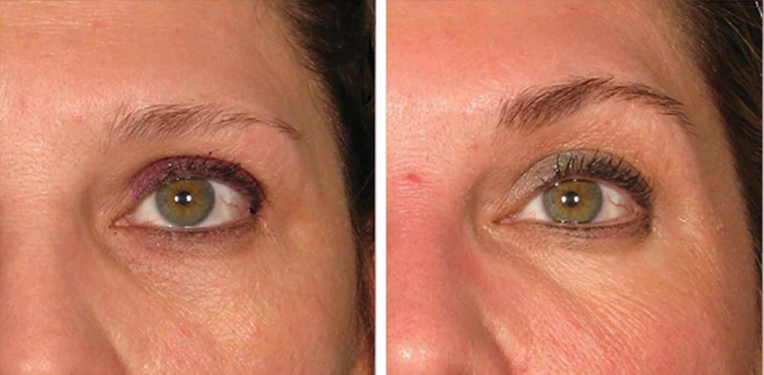 Брови подняты всего на несколько миллиметров, а взгляд уже более открытый