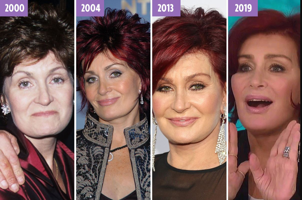 Как пластика и время меняли внешность Шэрон Осборн