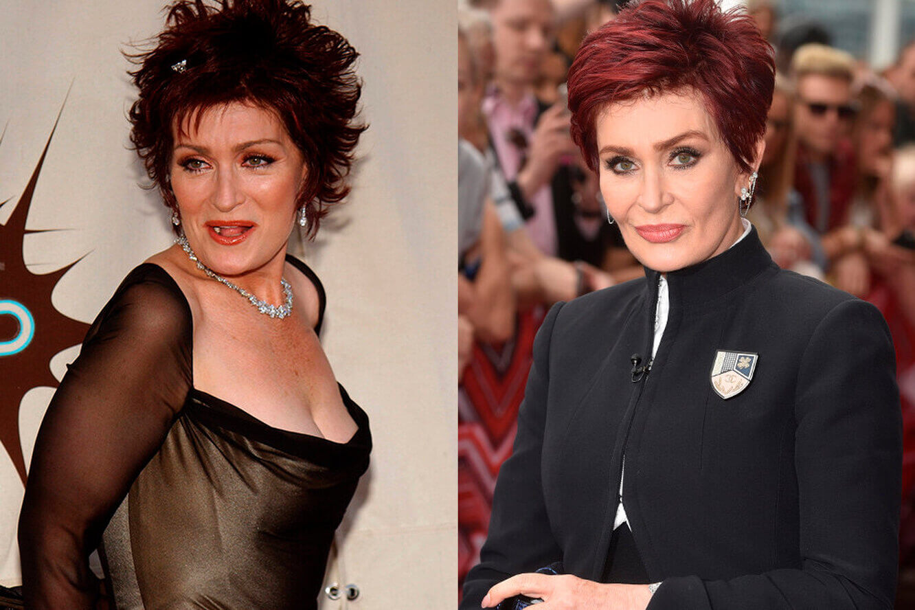 Шэрон Осборн до и после пластики