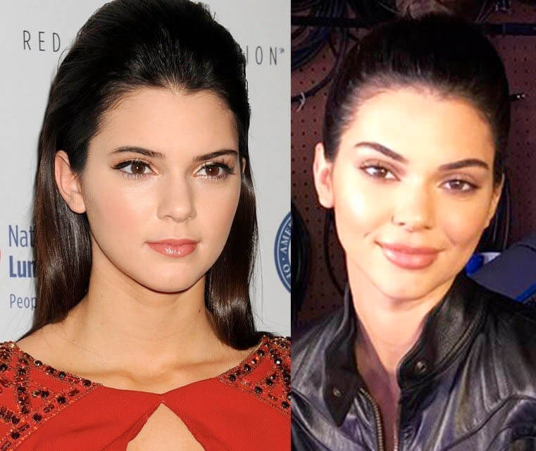 Звездный броулифтинг фото до&nbsp;после