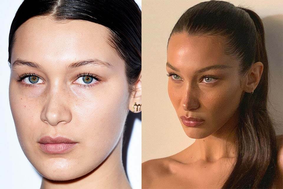 Фото до&nbsp;после темпоропластики Беллы Хадид