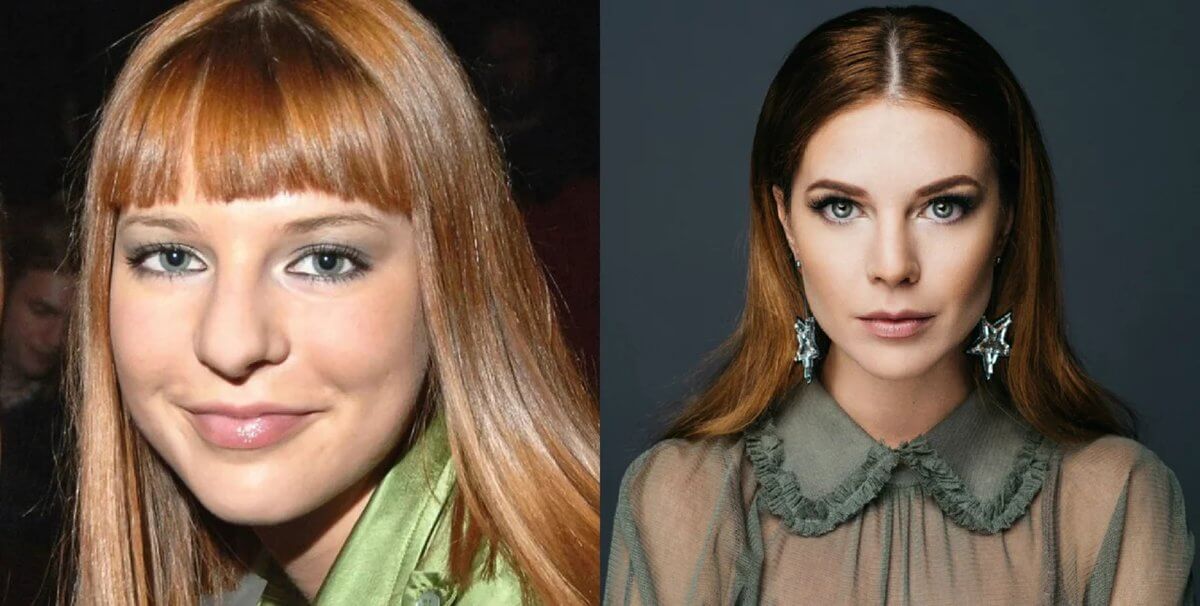 После ринопластики и уколов красоты Наталью Подольскую трудно узнать