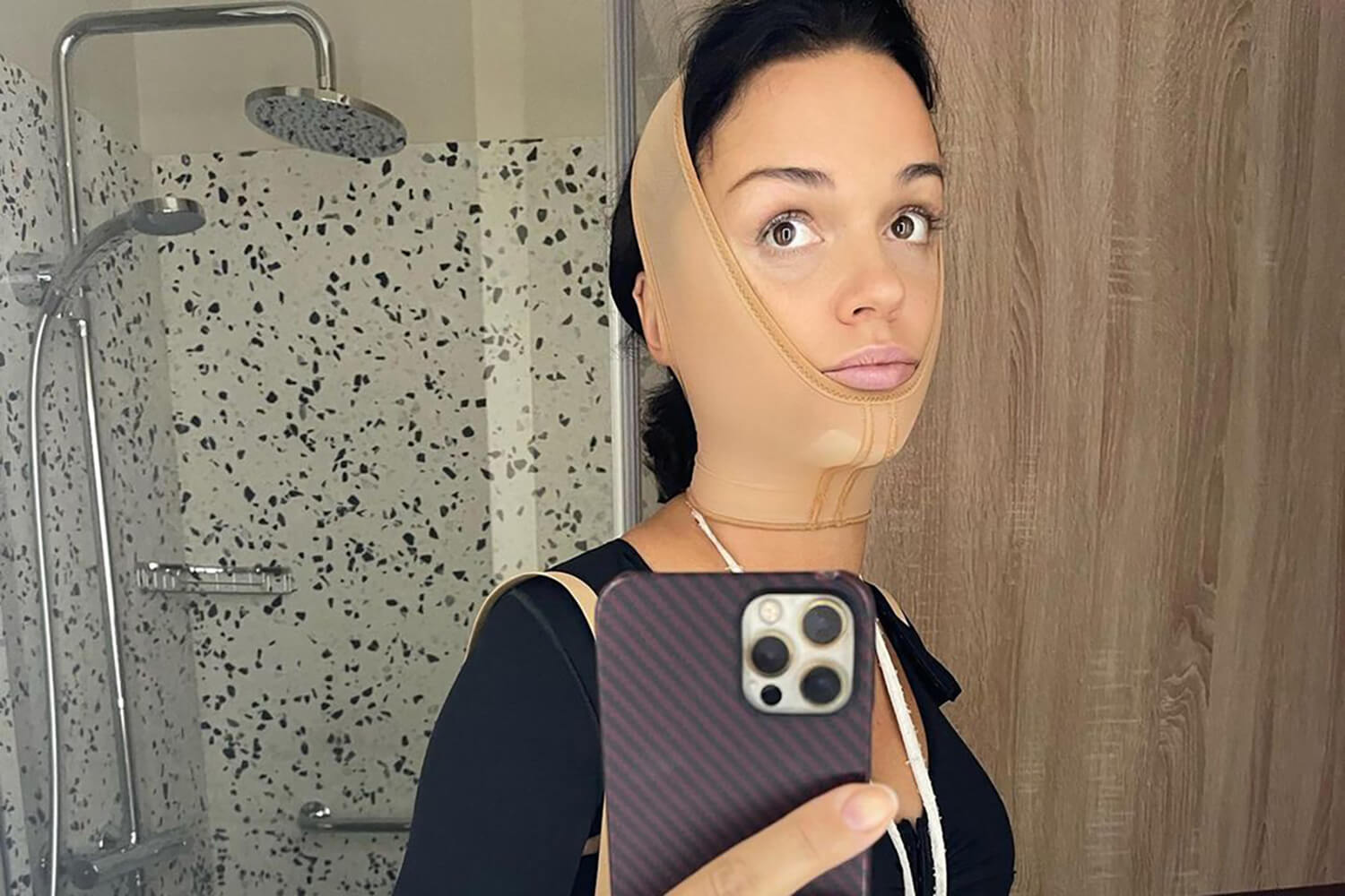 Слава не&nbsp;скрывает факт пластики и&nbsp;активно делится фото в&nbsp;бинтах с&nbsp;фанатами и&nbsp;СМИ