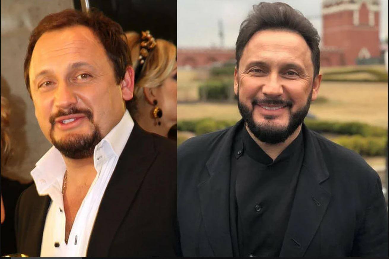 Стас Михайлов &ndash; фото до&nbsp;и&nbsp;после пластики