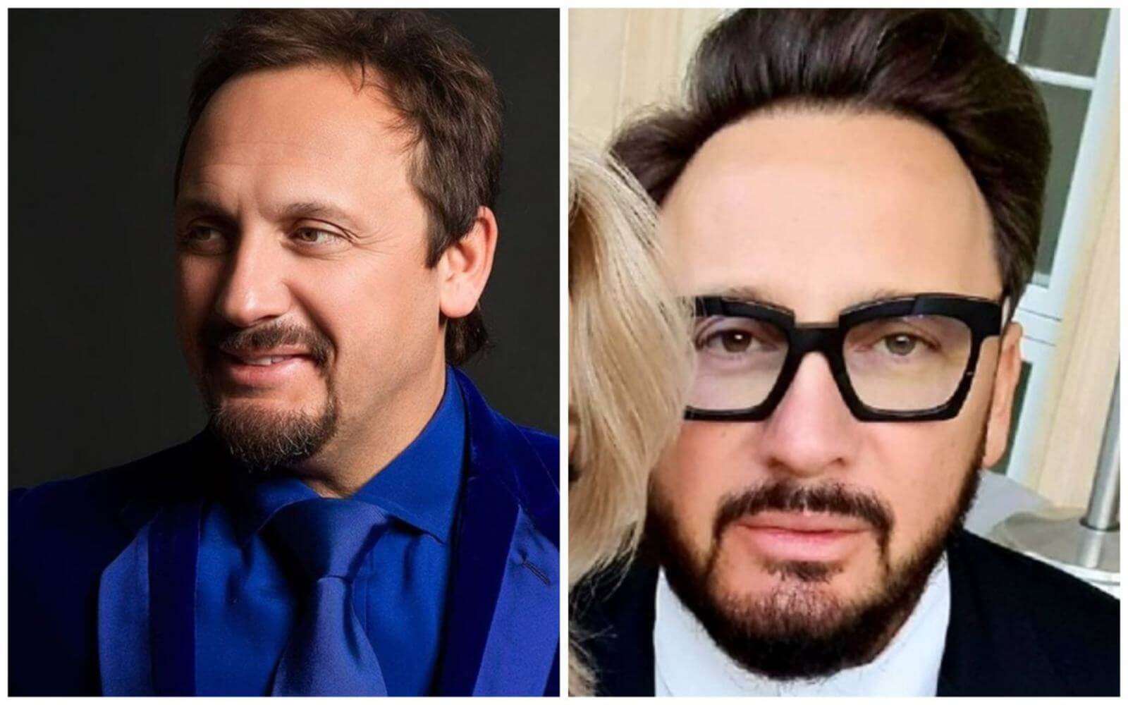 Пухлые губы и&nbsp;отсутствие морщин &ndash; фото Стаса Михайлов до&nbsp;и&nbsp;после пластики