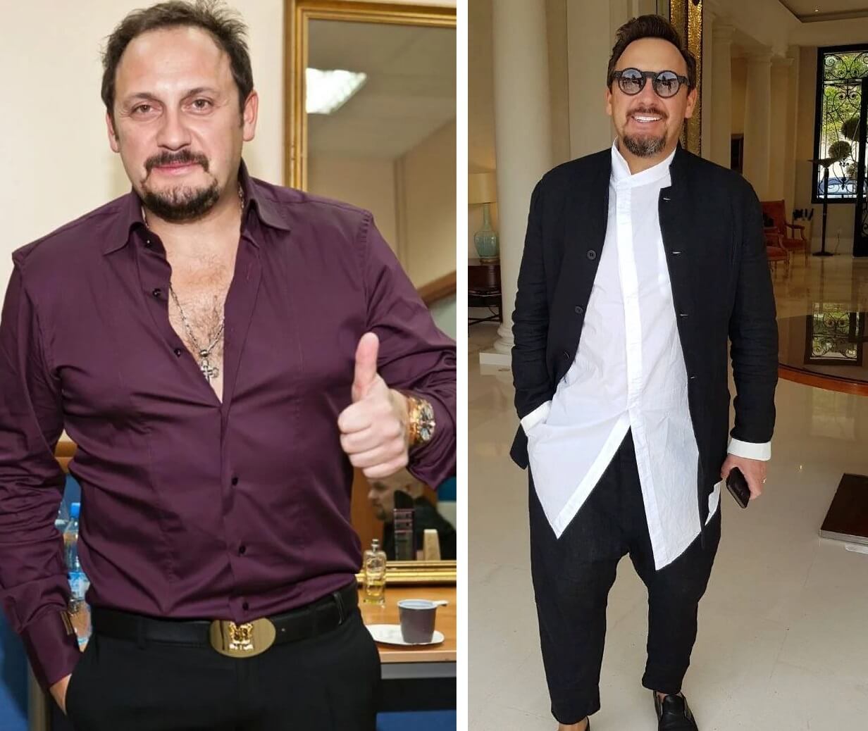 Стас Михайлов не&nbsp;только сделал пластику, но&nbsp;и&nbsp;полностью поменял образ