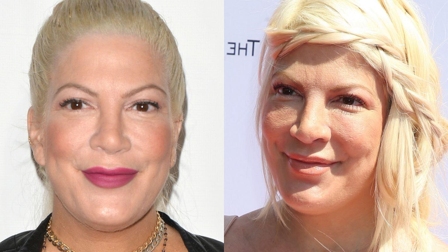 Пластика Тори Спеллинг – пример того, как не нужно корректировать свою внешность 