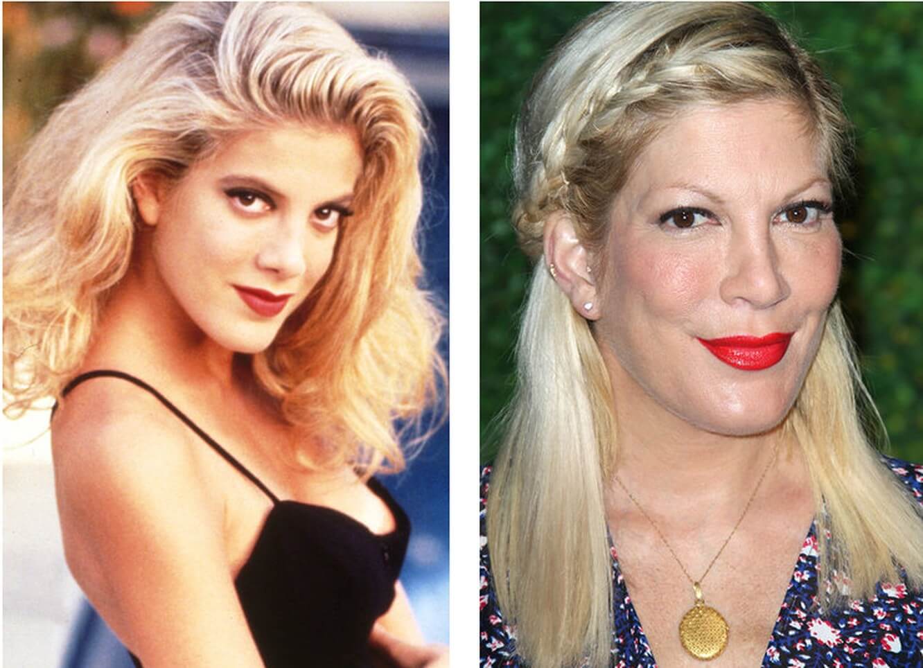 Тори Спеллинг – пластика и годы берут свое