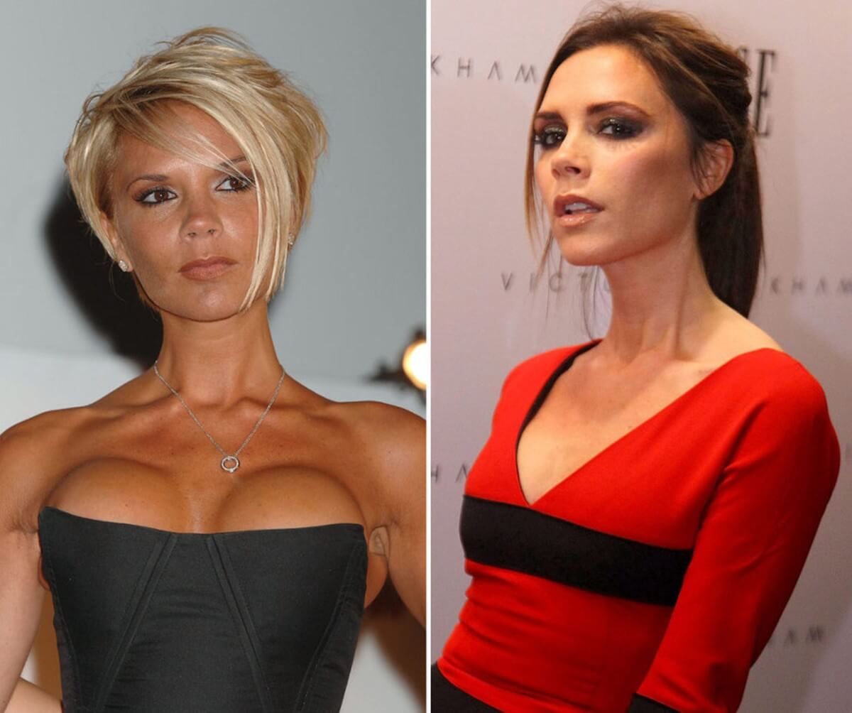 Викторию Бекхэм много критиковали за&nbsp;неестественный вид силиконового бюста. В&nbsp;итоге звезда избавилась от&nbsp;имплантов 