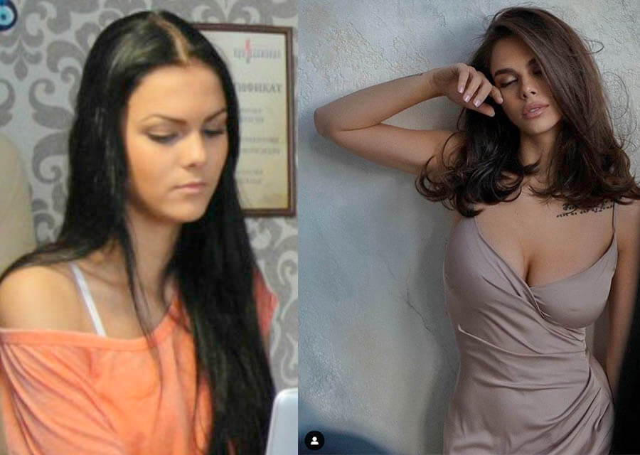 Вики Одинцова до пластики и после