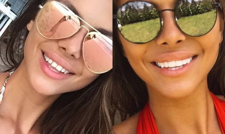 Вики Одинцова виниры