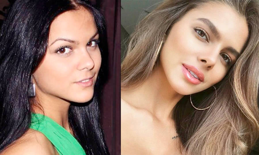 Вики Одинцова нос