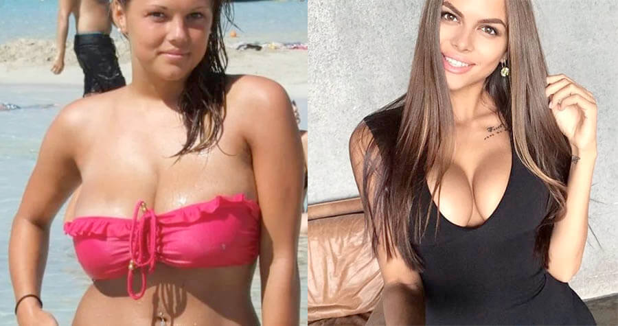 Вики Одинцова до и после