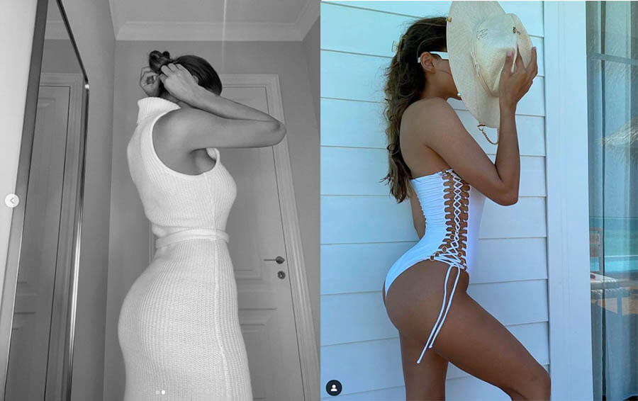 Вики Одинцова после пластики