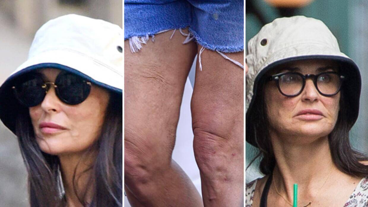 Поговаривают, что морщинистые колени Деми Мур &ndash; результат неудачной липосакции