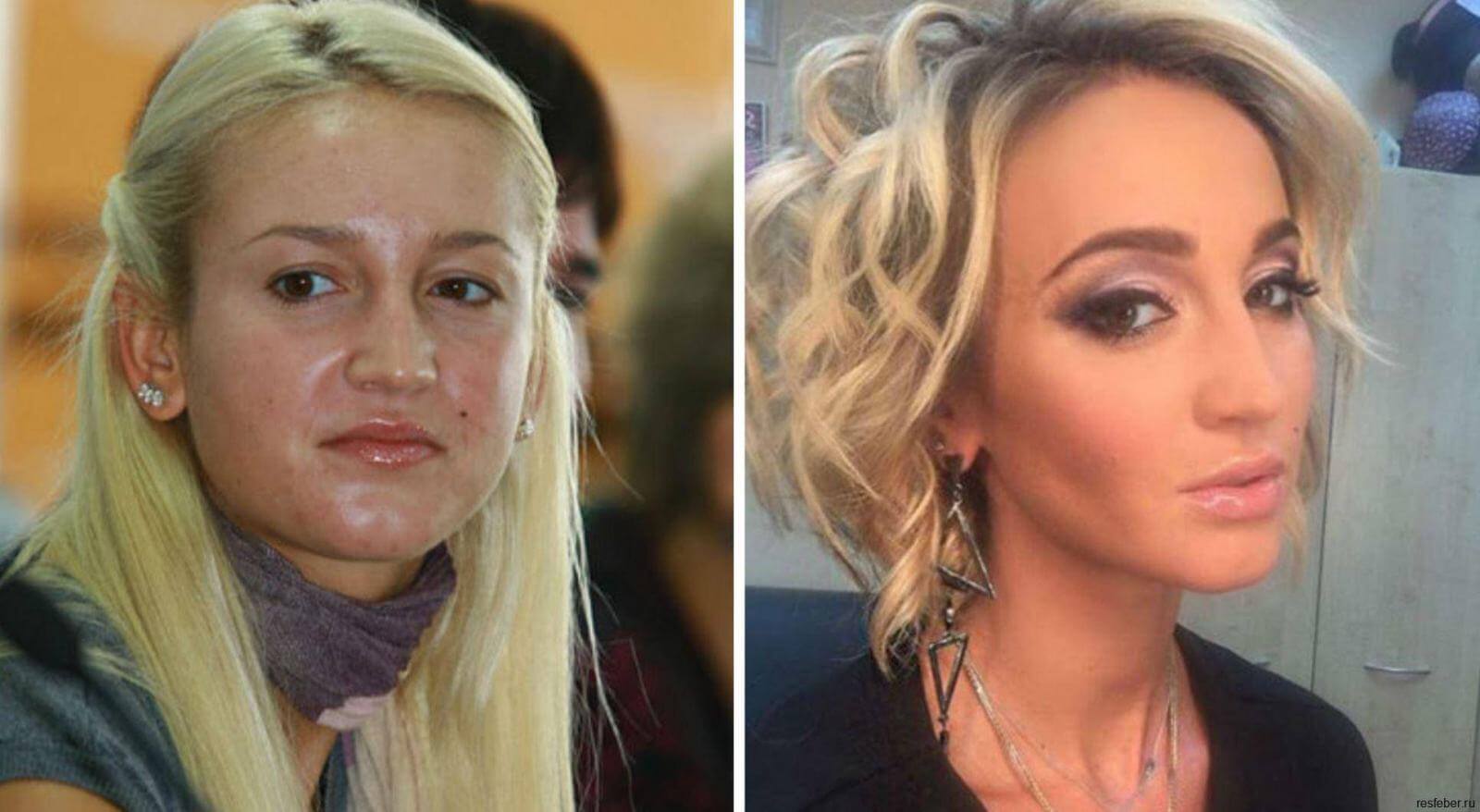 Ольга Бузова – работа косметологов и хирургов налицо